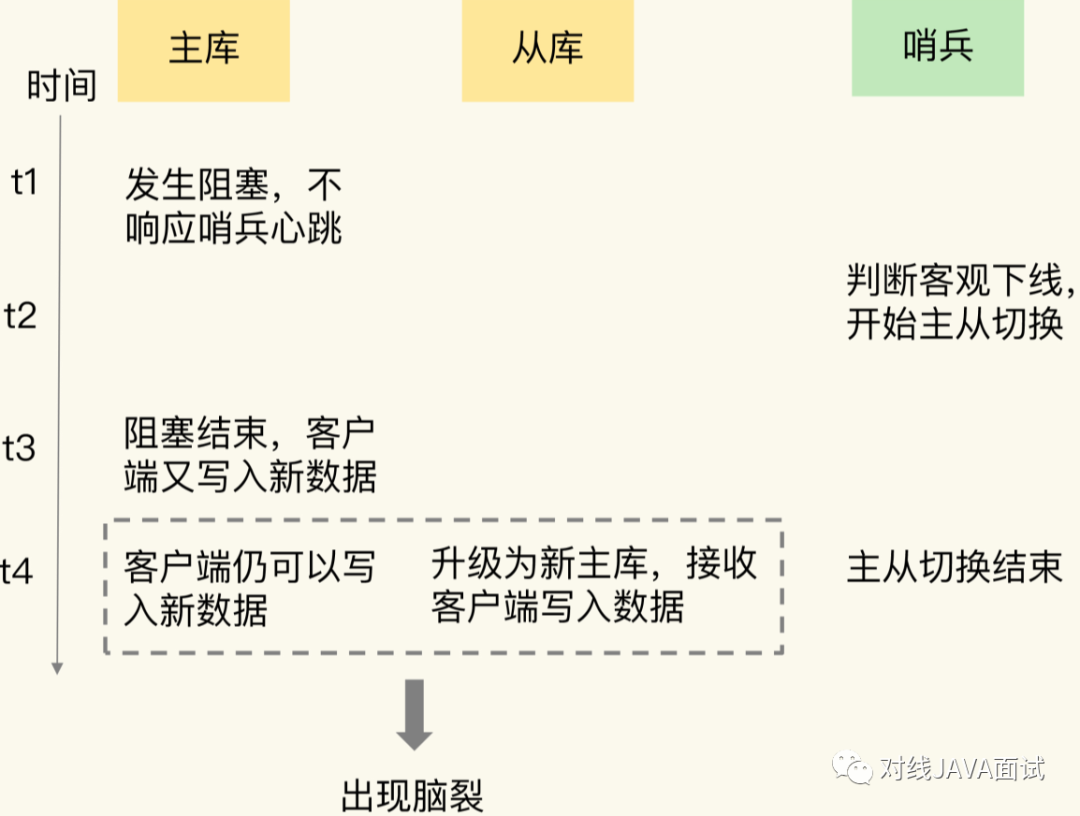 brain